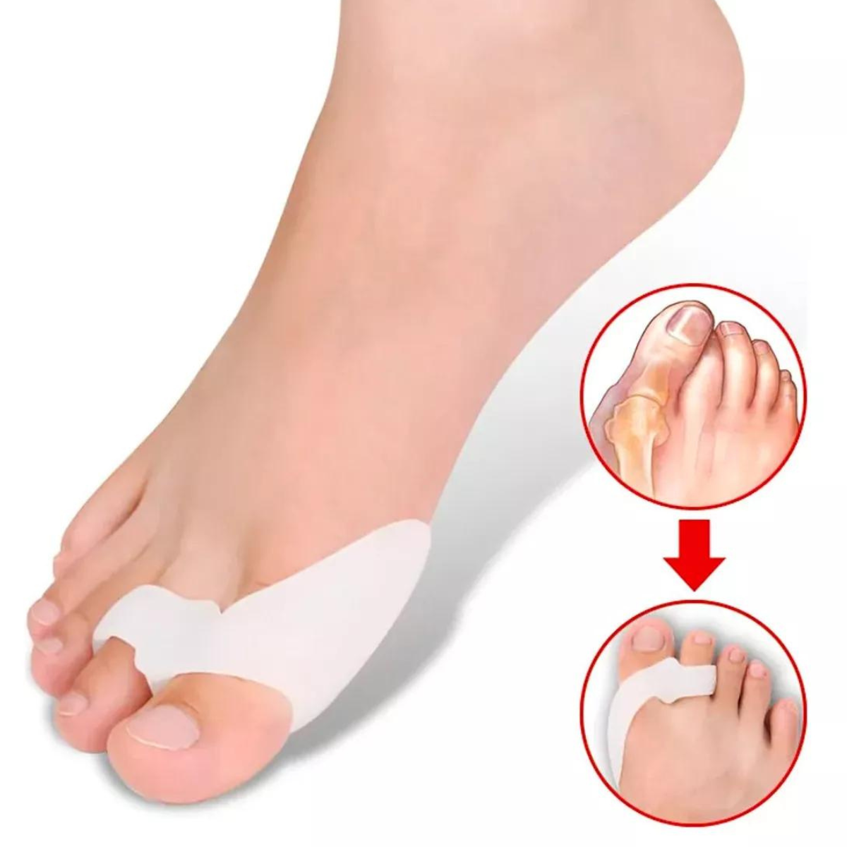 Protector de silicona para juanetes